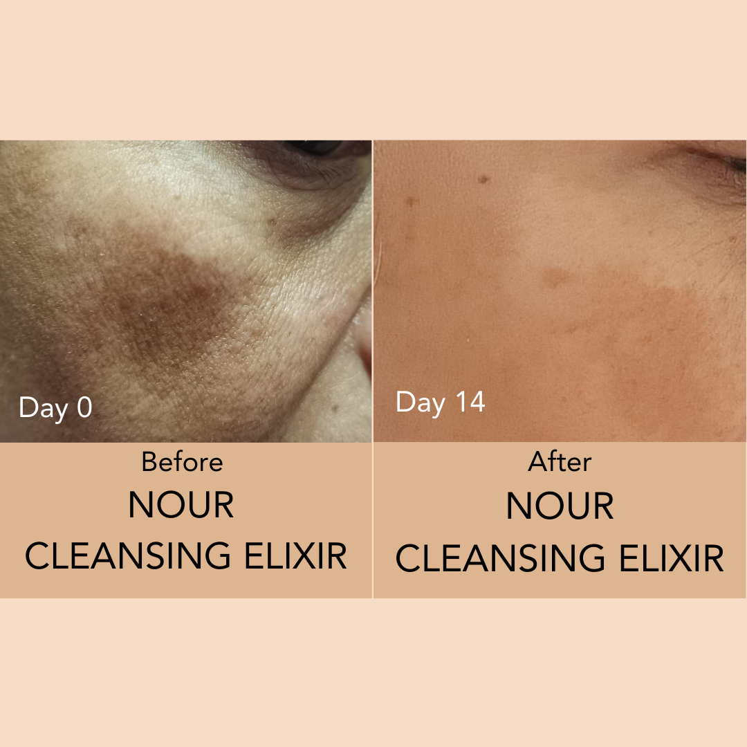 NOUR CLEANSING ELIXIR - 30 ml | 1.01 fl. oz