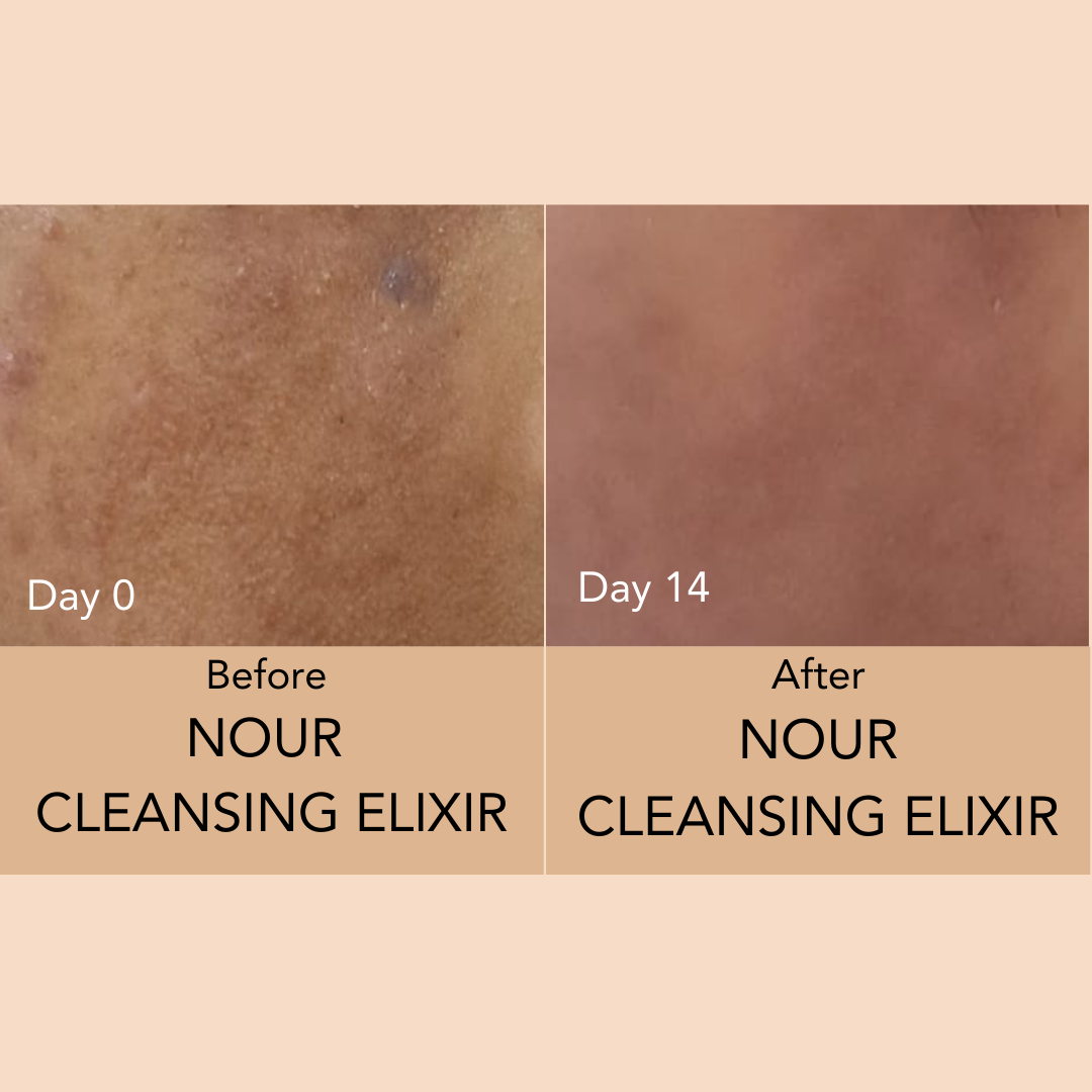 NOUR CLEANSING ELIXIR - 30 ml | 1.01 fl. oz